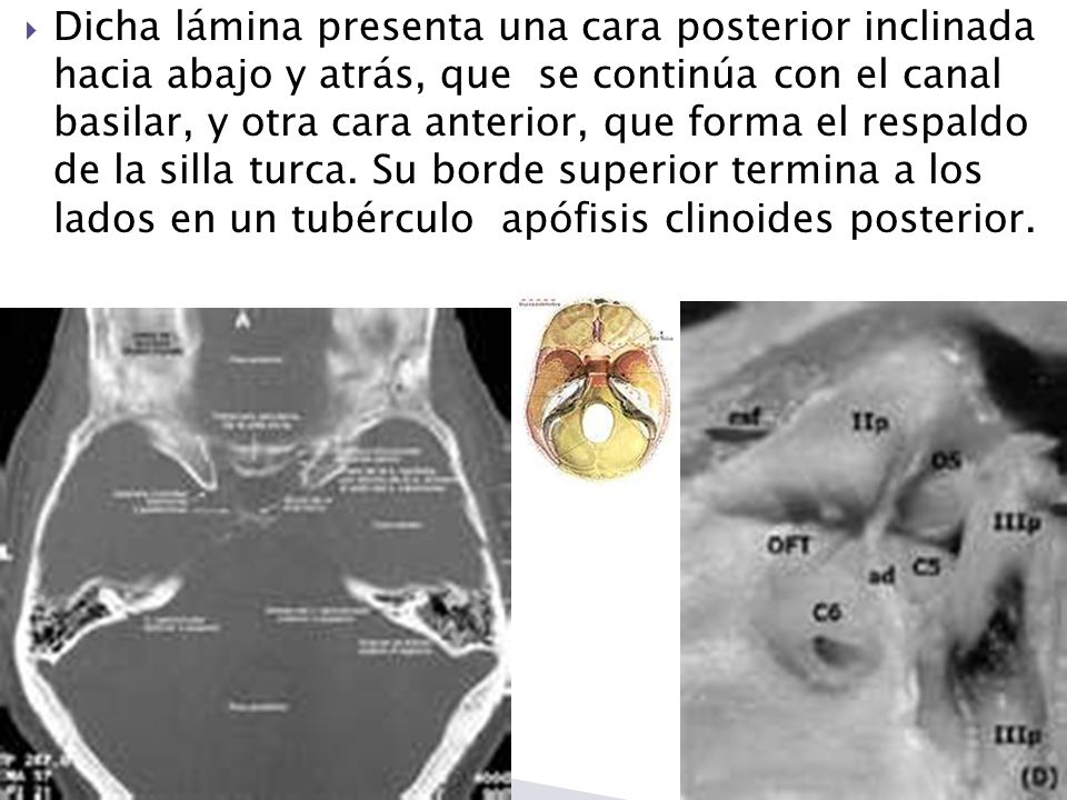 Dicha lámina presenta una cara posterior inclinada hacia abajo y atrás, que se continúa con el canal basilar, y otra cara anterior, que forma el respaldo de la silla turca.