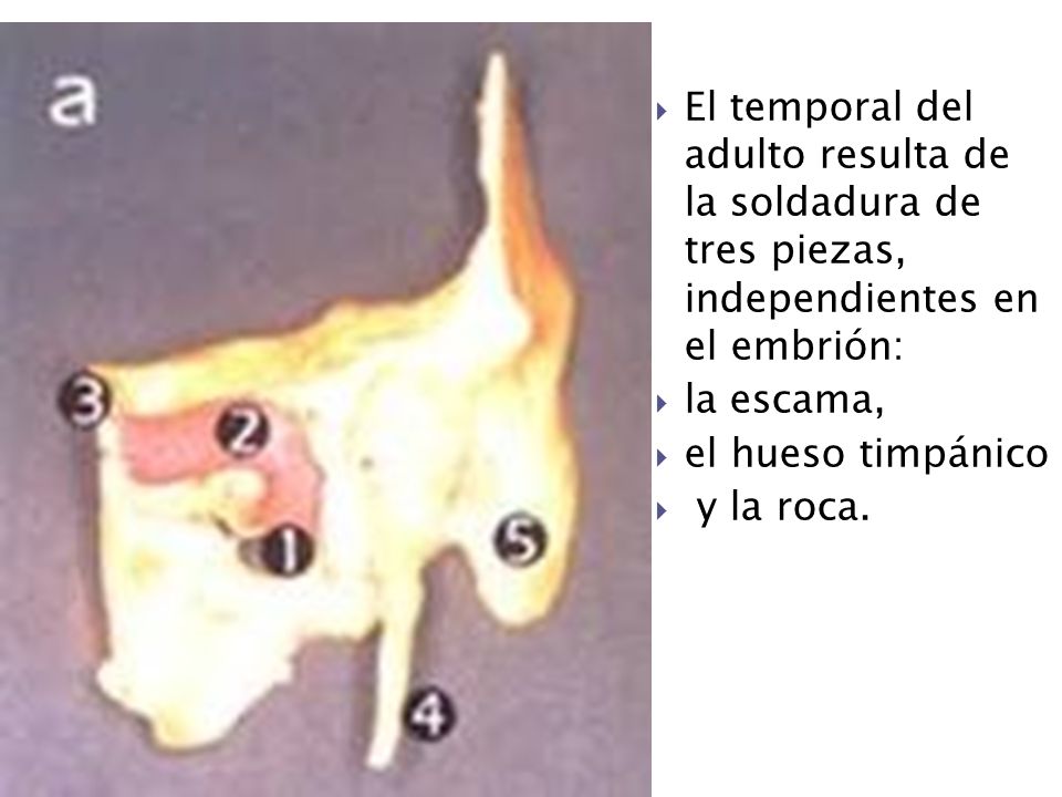 El temporal del adulto resulta de la soldadura de tres piezas, independientes en el embrión: