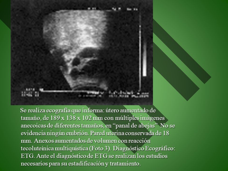 Se realiza ecografía que informa: útero aumentado de tamaño, de 189 x 138 x 102 mm con múltiples imágenes anecoicas de diferentes tamaños, en panal de abejas No se evidencia ningún embrión.