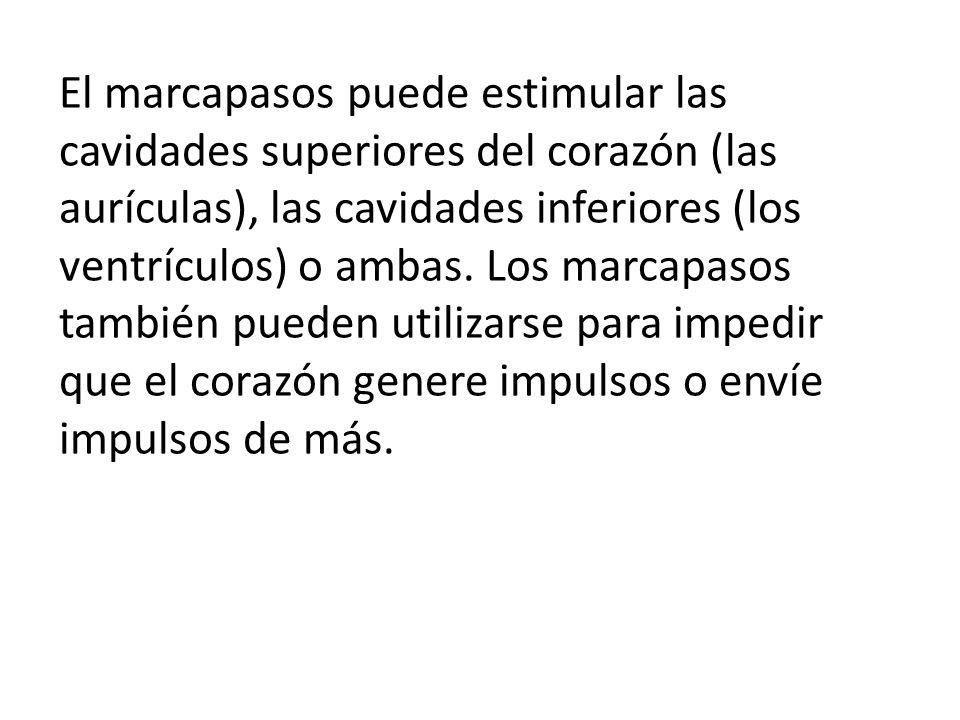 El marcapasos puede estimular las cavidades superiores del corazón (las aurículas), las cavidades inferiores (los ventrículos) o ambas.