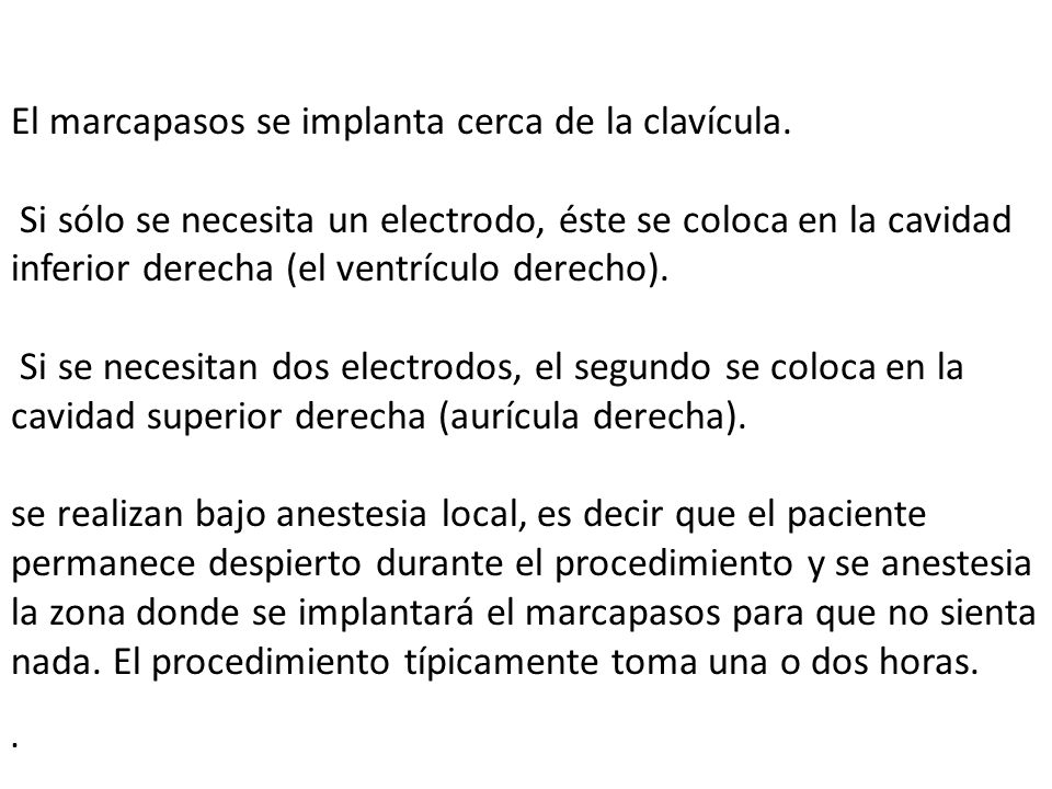 El marcapasos se implanta cerca de la clavícula.