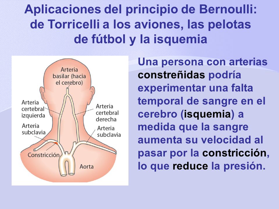 Aplicaciones del principio de Bernoulli: de Torricelli a los aviones, las pelotas de fútbol y la isquemia