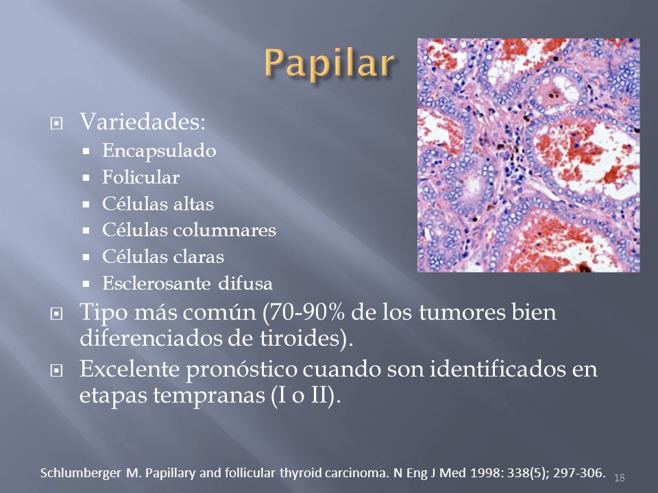 Papilar Variedades: Encapsulado. Folicular. Células altas. Células columnares. Células claras.
