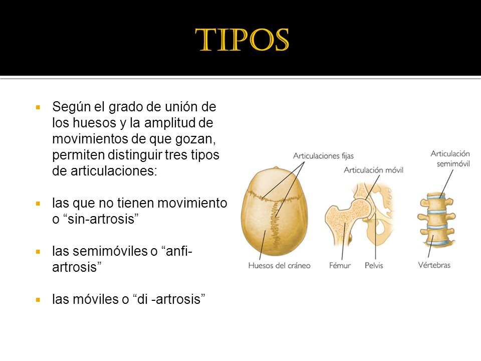 tipos Según el grado de unión de los huesos y la amplitud de movimientos de que gozan, permiten distinguir tres tipos de articulaciones: