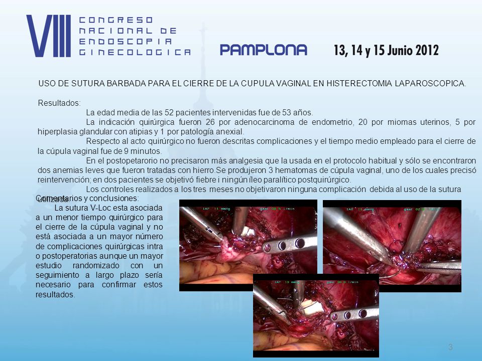 USO DE SUTURA BARBADA PARA EL CIERRE DE LA CUPULA VAGINAL EN HISTERECTOMIA LAPAROSCOPICA.
