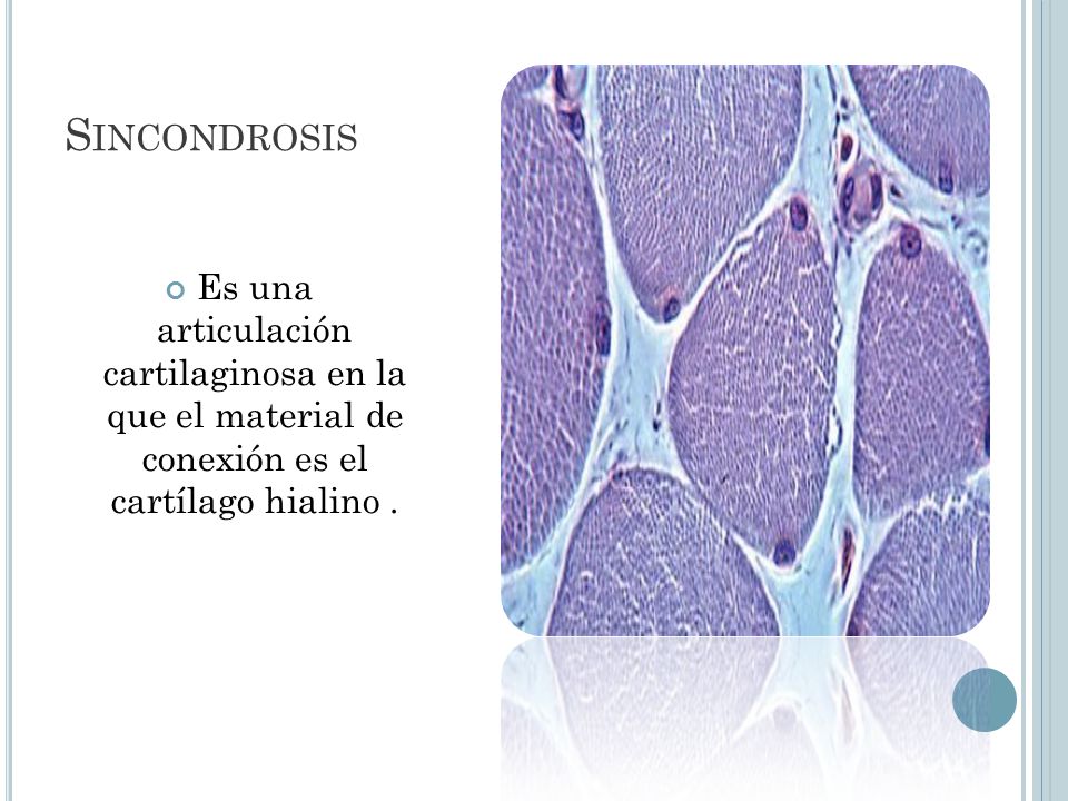 Sincondrosis Es una articulación cartilaginosa en la que el material de conexión es el cartílago hialino .