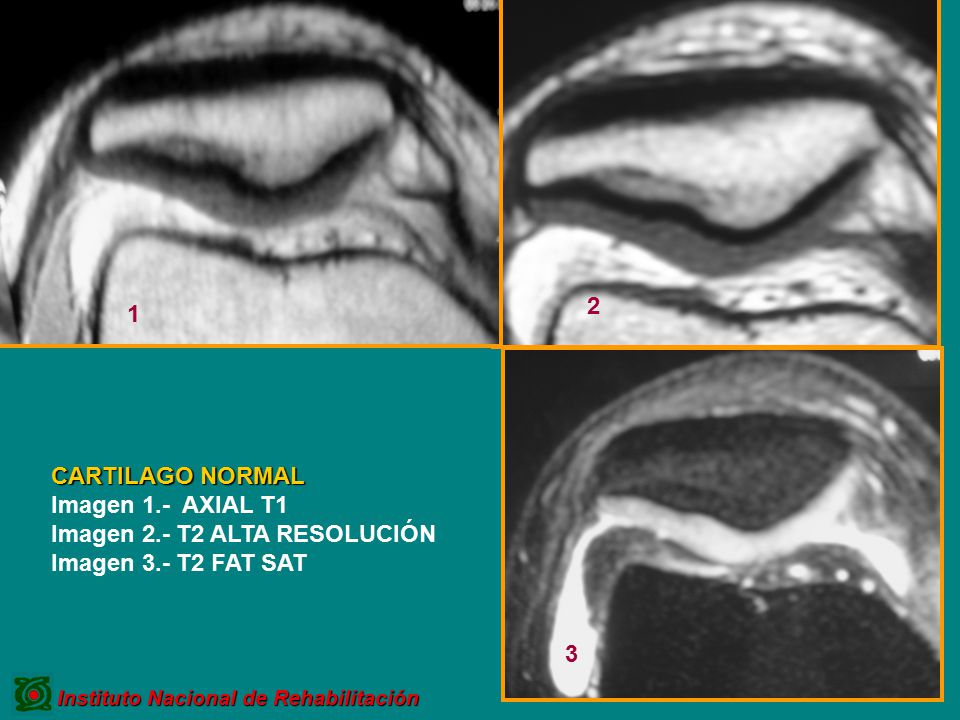 Imagen 2.- T2 ALTA RESOLUCIÓN Imagen 3.- T2 FAT SAT