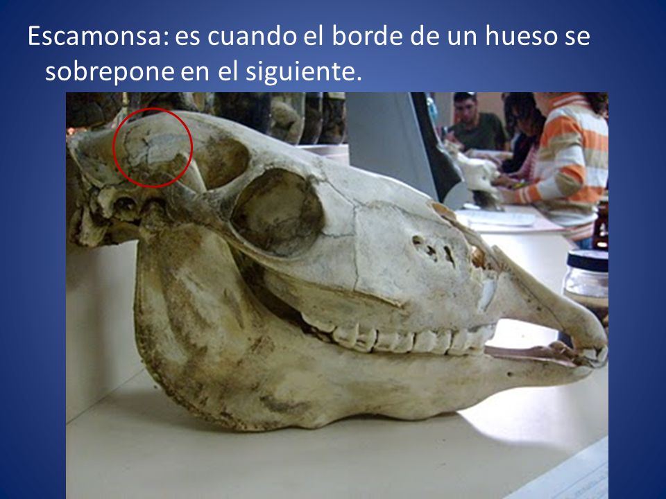 Escamonsa: es cuando el borde de un hueso se sobrepone en el siguiente.