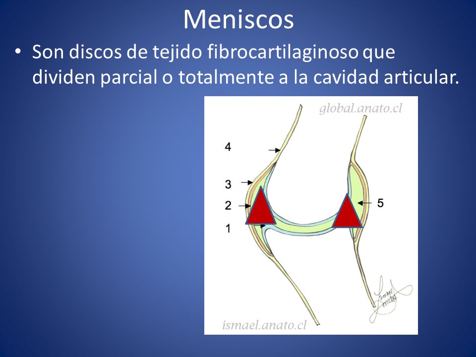 Meniscos Son discos de tejido fibrocartilaginoso que dividen parcial o totalmente a la cavidad articular.