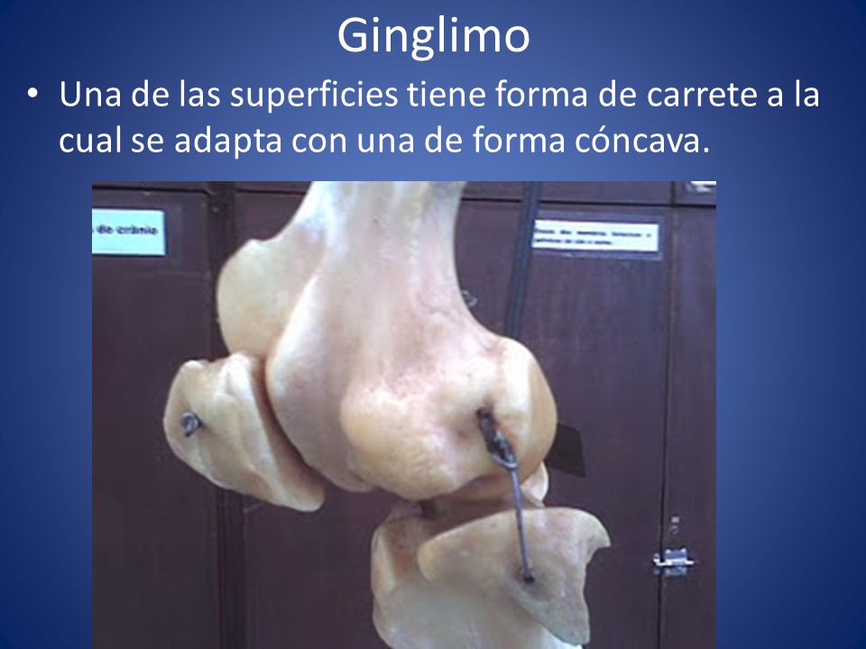 Ginglimo Una de las superficies tiene forma de carrete a la cual se adapta con una de forma cóncava.