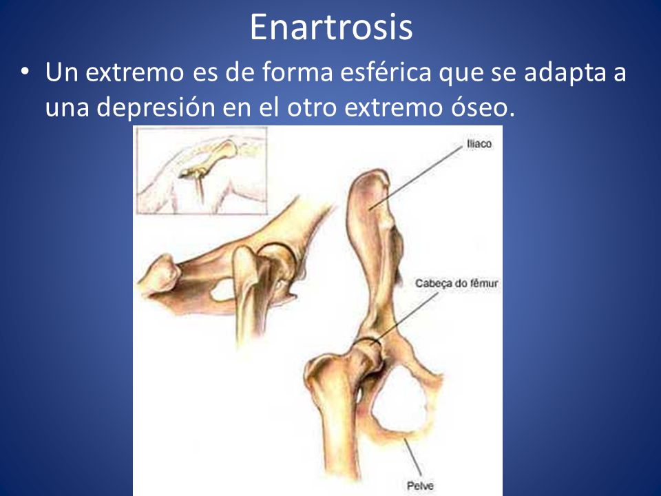 Enartrosis Un extremo es de forma esférica que se adapta a una depresión en el otro extremo óseo.