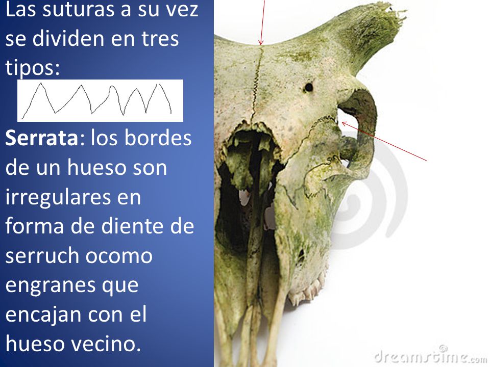 Las suturas a su vez se dividen en tres tipos: