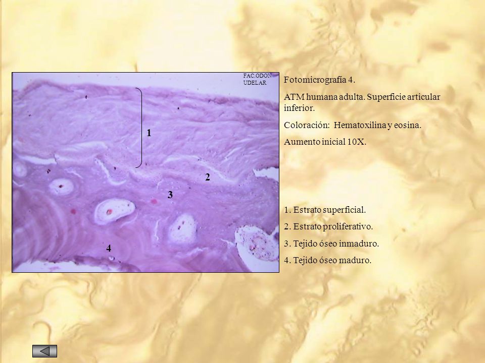 FAC.ODON UDELAR. Fotomicrografía 4. ATM humana adulta. Superficie articular inferior. Coloración: Hematoxilina y eosina.