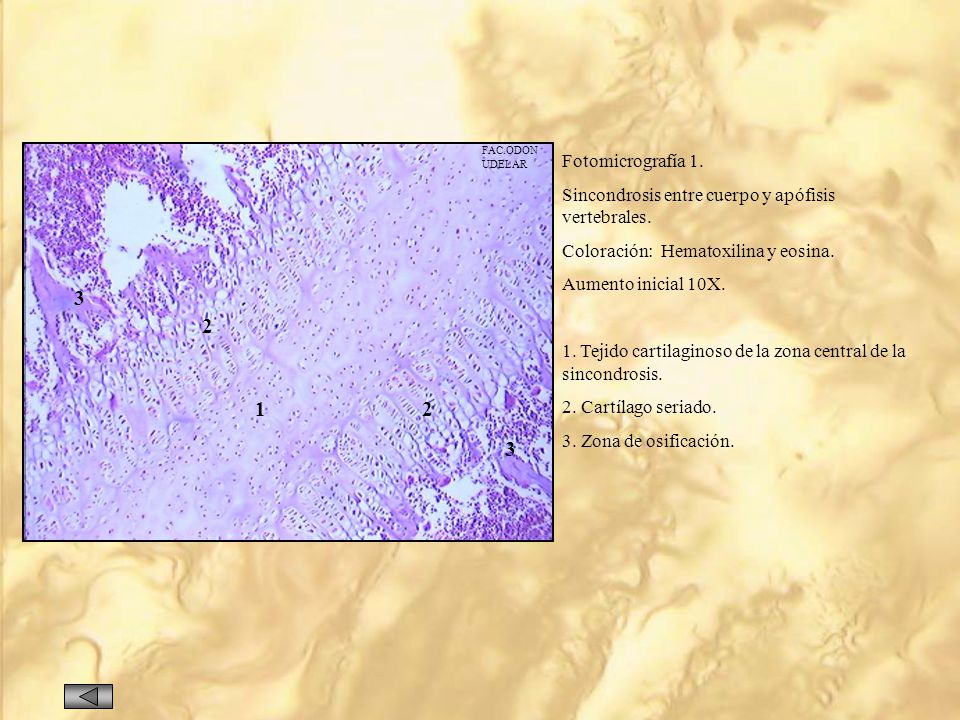FAC.ODON UDELAR. Fotomicrografía 1. Sincondrosis entre cuerpo y apófisis vertebrales. Coloración: Hematoxilina y eosina.