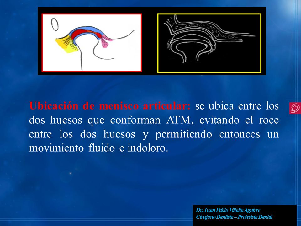Ubicación de menisco articular: se ubica entre los dos huesos que conforman ATM, evitando el roce entre los dos huesos y permitiendo entonces un movimiento fluido e indoloro.