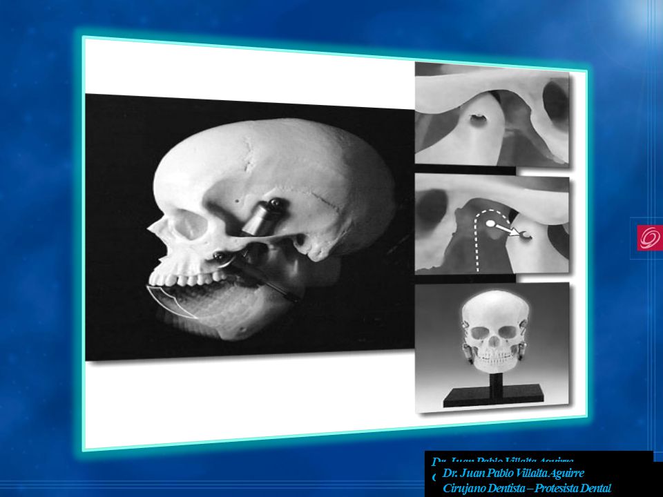 Dr. Juan Pablo Villalta Aguirre Cirujano Dentista – Protesista Dental