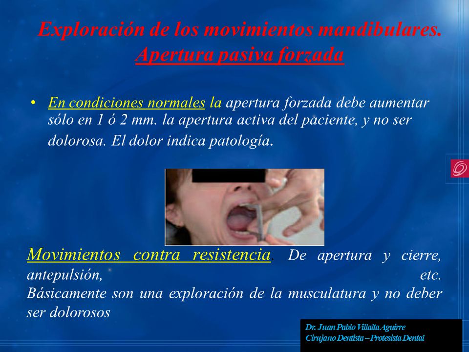 Exploración de los movimientos mandibulares. Apertura pasiva forzada