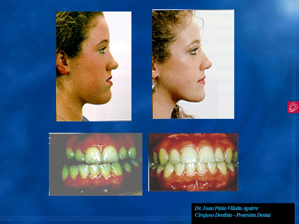 Dr. Juan Pablo Villalta Aguirre Cirujano Dentista – Protesista Dental