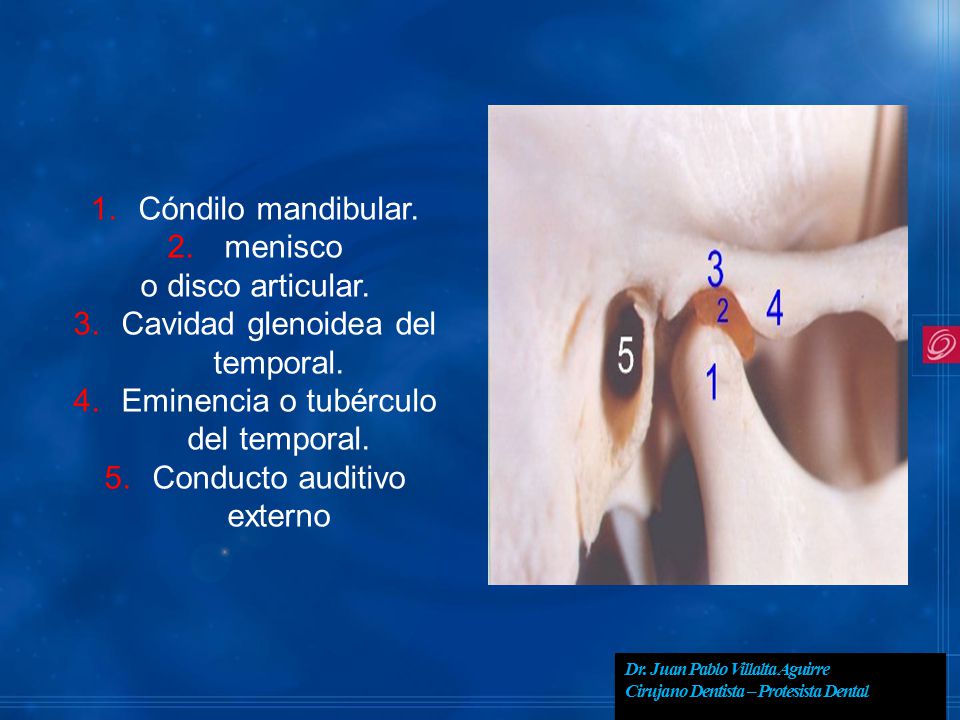Cavidad glenoidea del temporal. Eminencia o tubérculo del temporal.