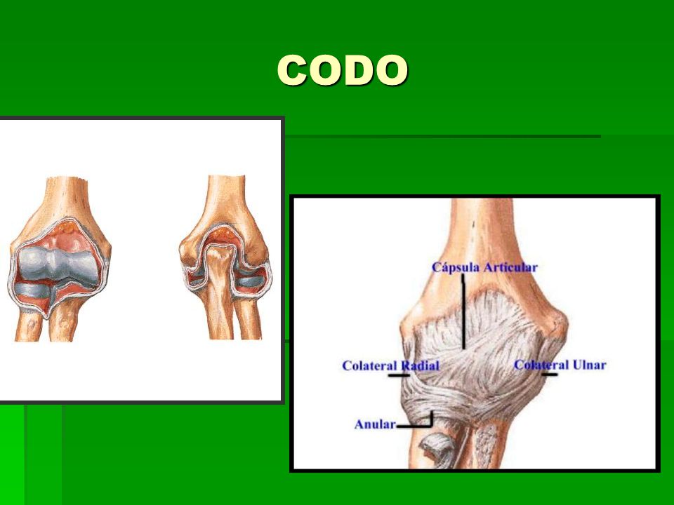 CODO