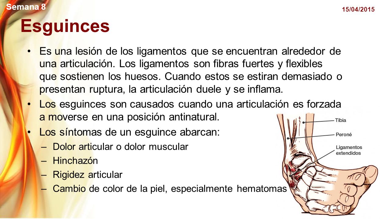 Semana 8 11/04/2017. Esguinces.