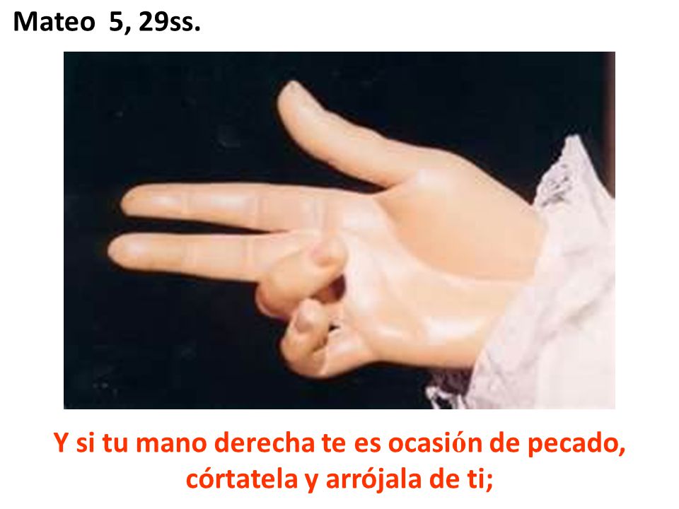 Mateo 5, 29ss. Y si tu mano derecha te es ocasión de pecado, córtatela y arrójala de ti;