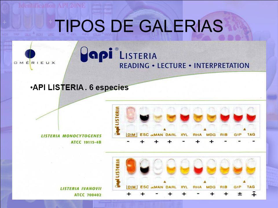 TIPOS DE GALERIAS API LISTERIA . 6 especies
