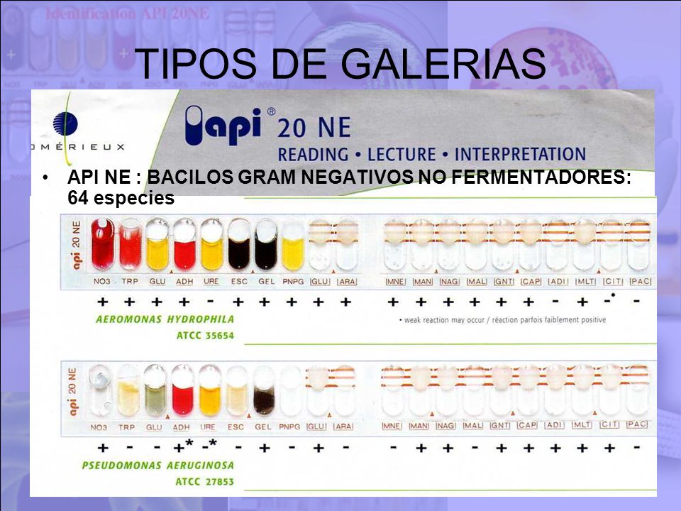 TIPOS DE GALERIAS API NE : BACILOS GRAM NEGATIVOS NO FERMENTADORES: 64 especies