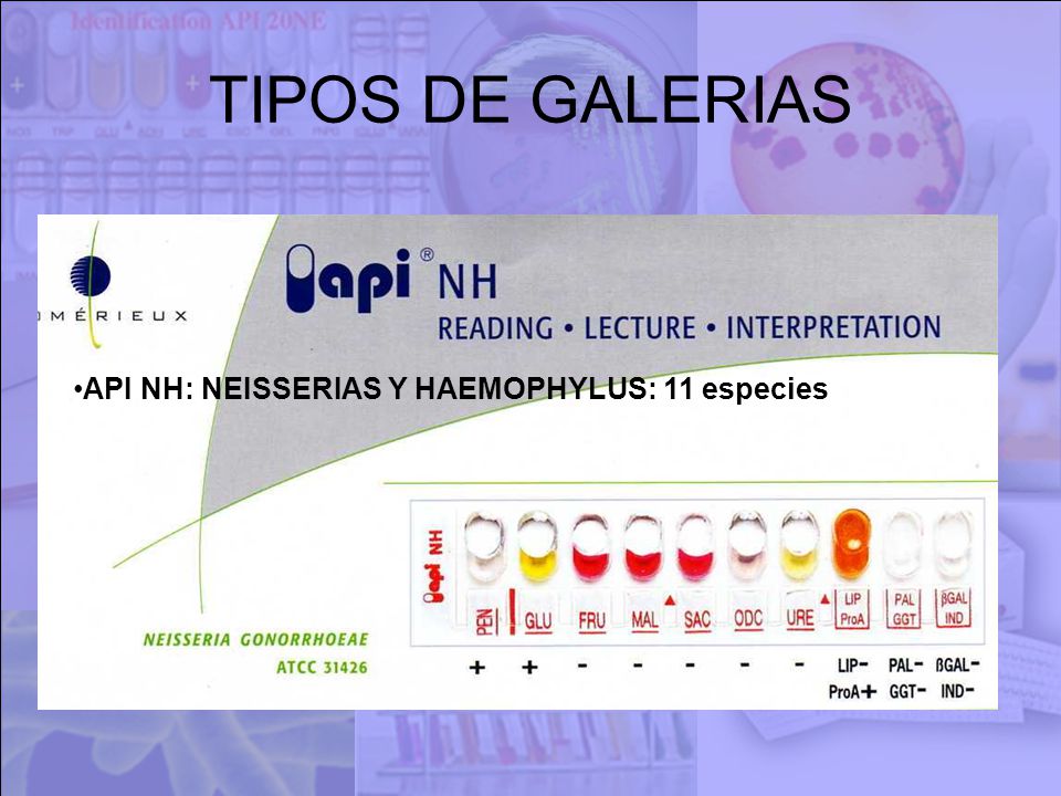 TIPOS DE GALERIAS API NH: NEISSERIAS Y HAEMOPHYLUS: 11 especies