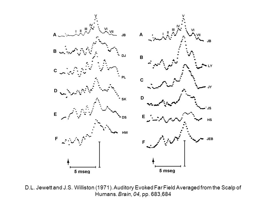 D. L. Jewett and J. S. Williston (1971)