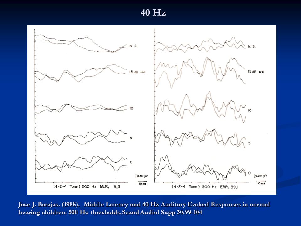 40 Hz Publication of Galambos et al (1981)- 40 Hz: superposition of transient middle latencies responses.