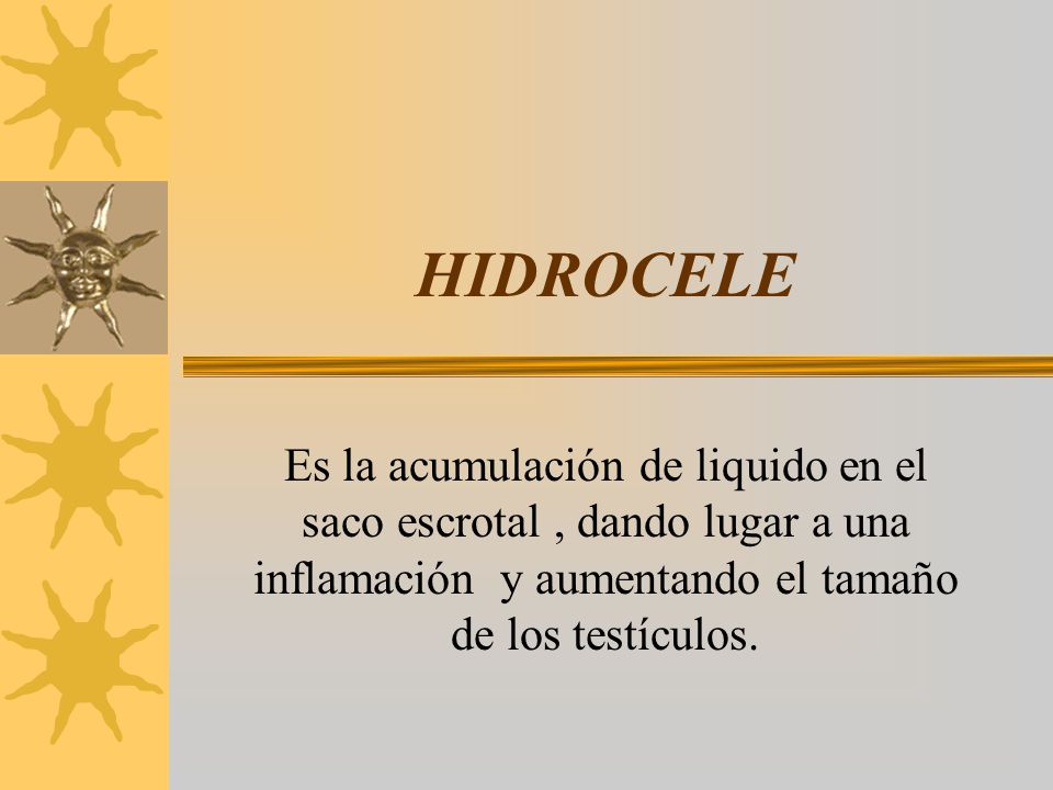 HIDROCELE Es la acumulación de liquido en el saco escrotal , dando lugar a una inflamación y aumentando el tamaño de los testículos.