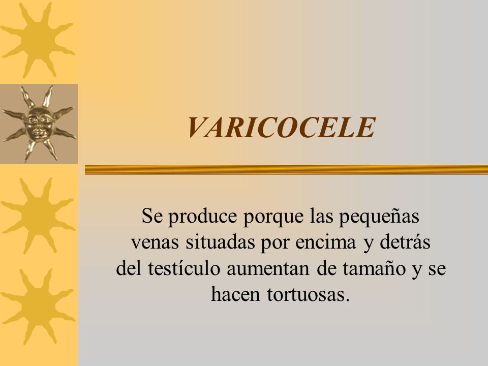 VARICOCELE Se produce porque las pequeñas venas situadas por encima y detrás del testículo aumentan de tamaño y se hacen tortuosas.