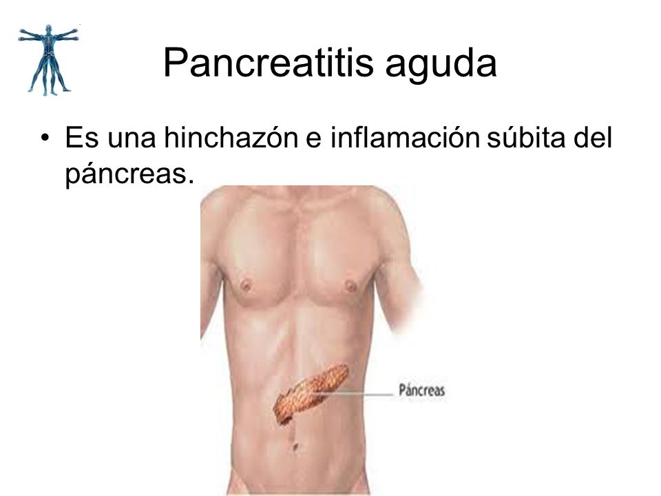 Pancreatitis aguda Es una hinchazón e inflamación súbita del páncreas.