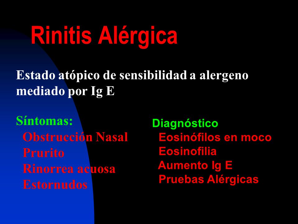 Rinitis Alérgica Estado atópico de sensibilidad a alergeno mediado por Ig E. Síntomas: Obstrucción Nasal.