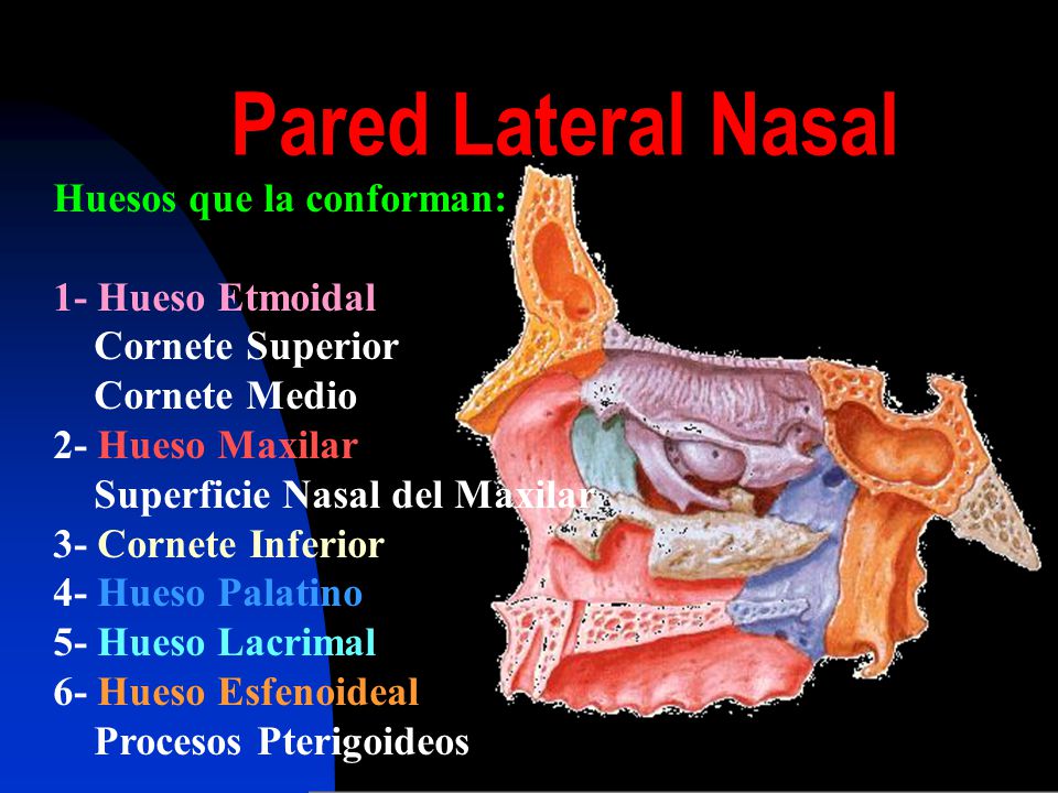 Pared Lateral Nasal Huesos que la conforman: 1- Hueso Etmoidal