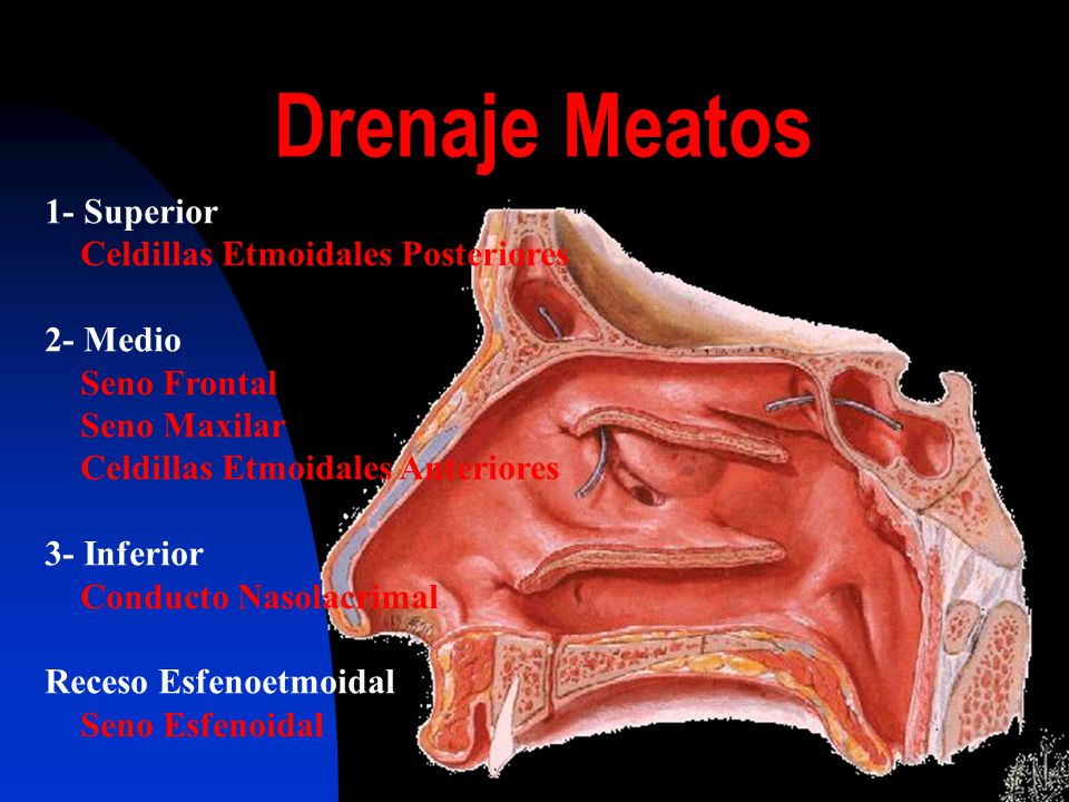 Drenaje Meatos 1- Superior Celdillas Etmoidales Posteriores 2- Medio