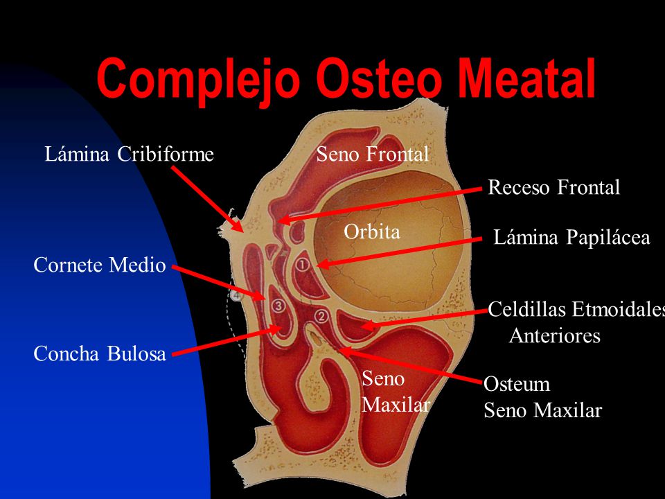 Complejo Osteo Meatal Lámina Cribiforme Seno Frontal Receso Frontal