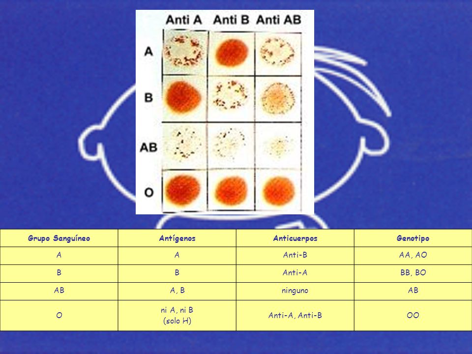 Grupo Sanguíneo Antígenos. Anticuerpos. Genotipo. A. Anti-B. AA, AO. B. Anti-A. BB, BO. AB.