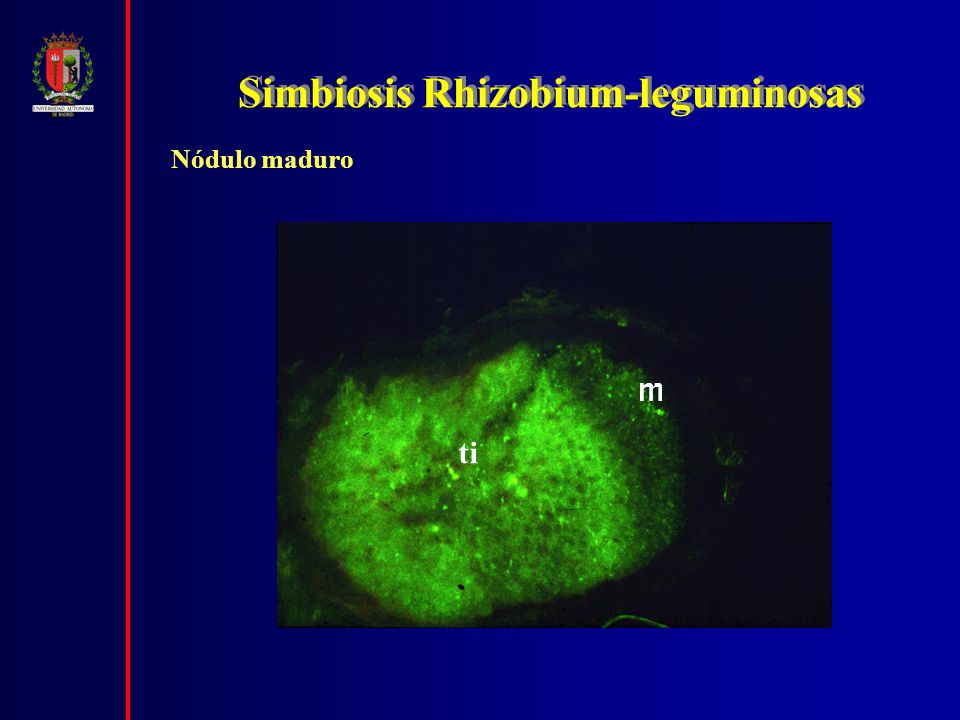 Simbiosis Rhizobium-leguminosas