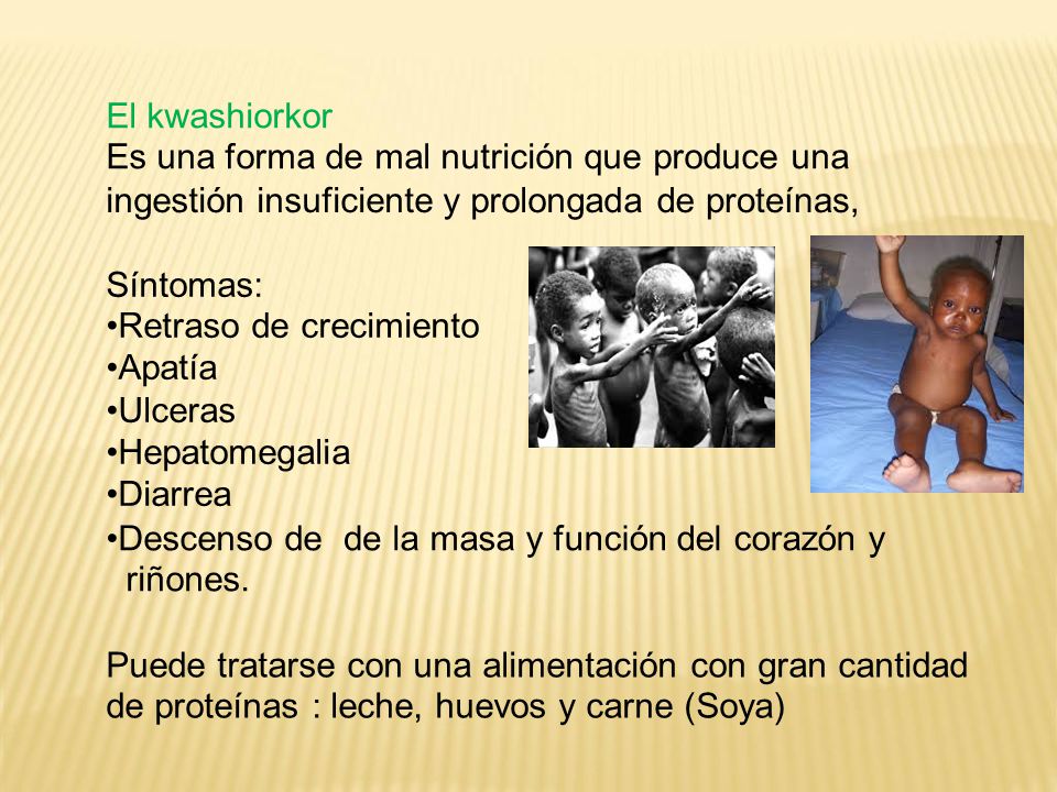 El kwashiorkor Es una forma de mal nutrición que produce una. ingestión insuficiente y prolongada.
