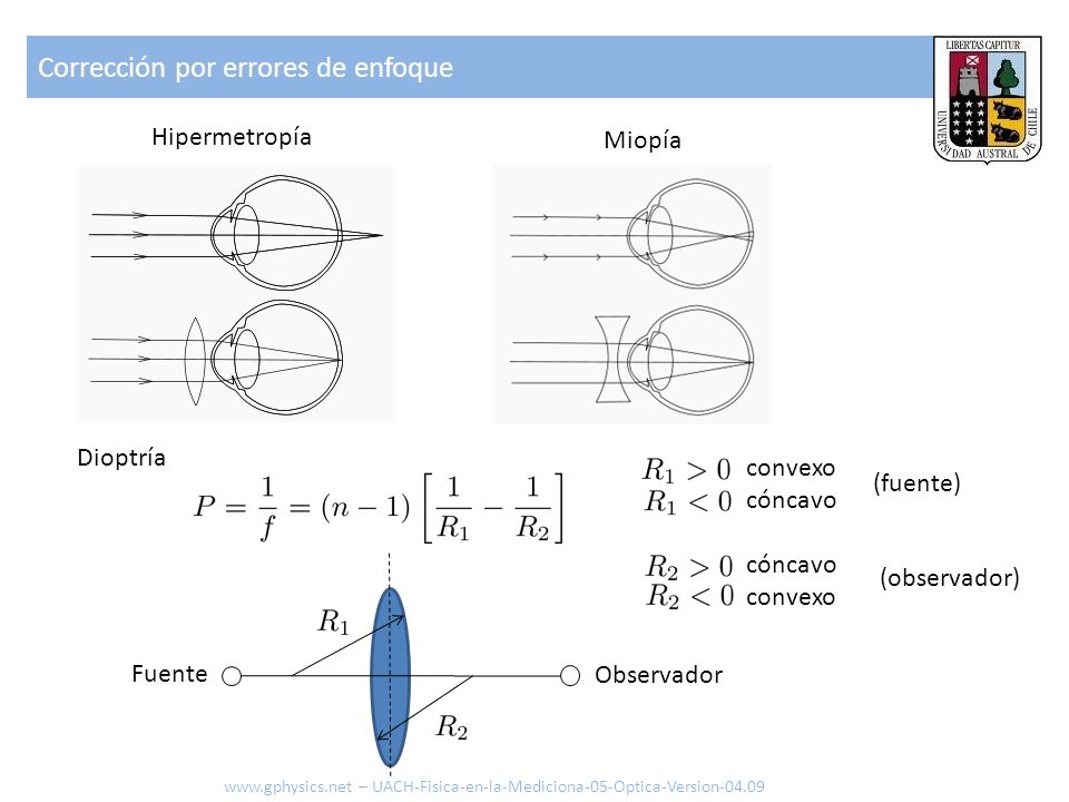 Corrección por errores de enfoque