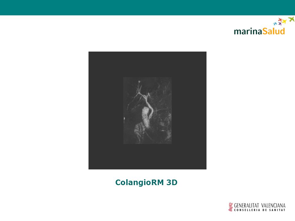 ColangioRM 3D