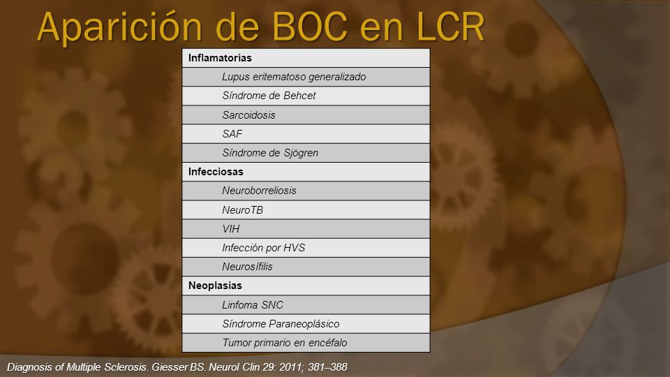 Aparición de BOC en LCR Inflamatorias Lupus eritematoso generalizado