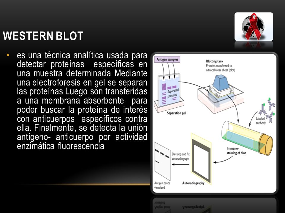 Western Blot