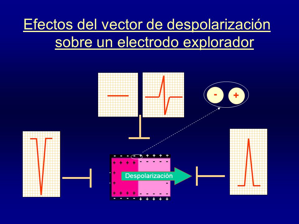Efectos del vector de despolarización sobre un electrodo explorador