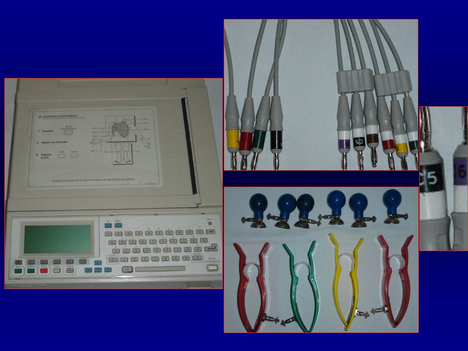 En las derivaciones precordiales en el cable pone el número de derivación: C1, C2, etc.