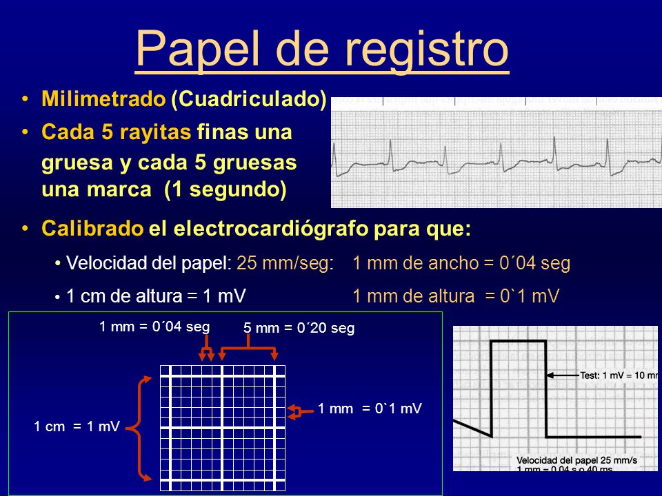 Papel de registro Milimetrado (Cuadriculado) Cada 5 rayitas finas una