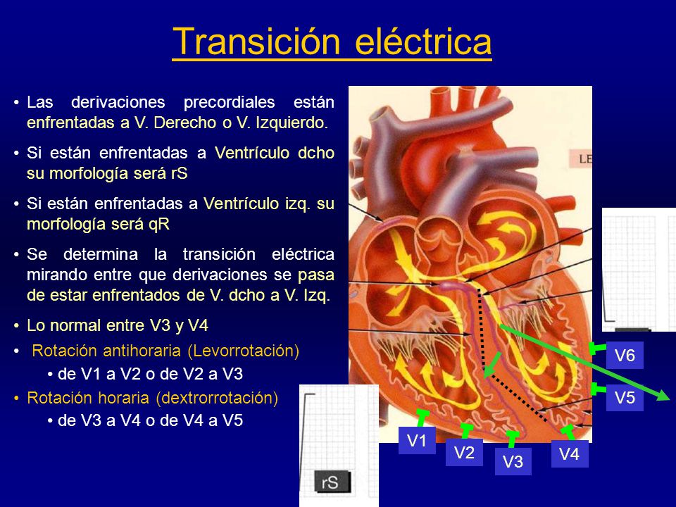 Transición eléctrica Las derivaciones precordiales están enfrentadas a V. Derecho o V. Izquierdo.