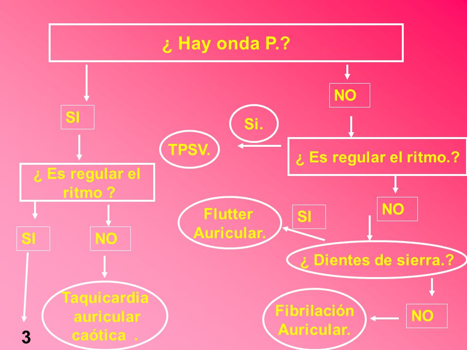 ¿ Hay onda P. 3 NO SI Si. TPSV. ¿ Es regular el ritmo.